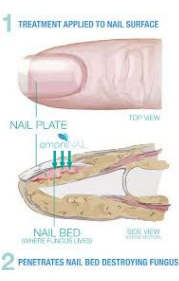 Picture of nail bed