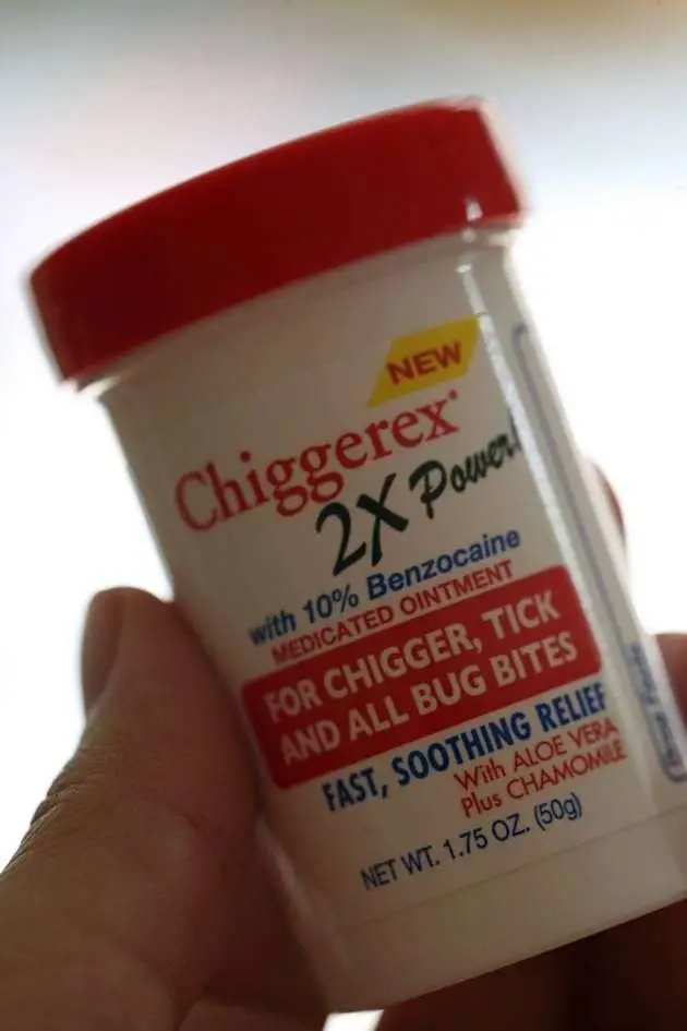 Pin on Chigger bite remedy