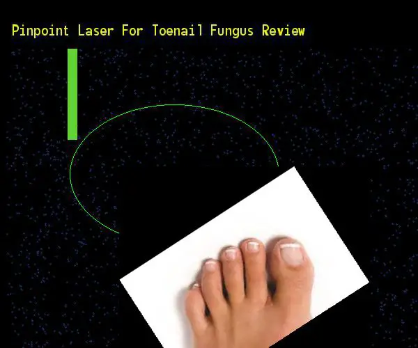 Pinpoint laser for toenail fungus review