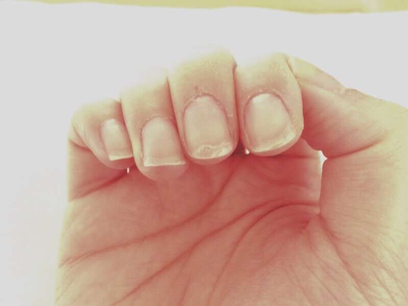 Prevent Breaking And Peeling Nails