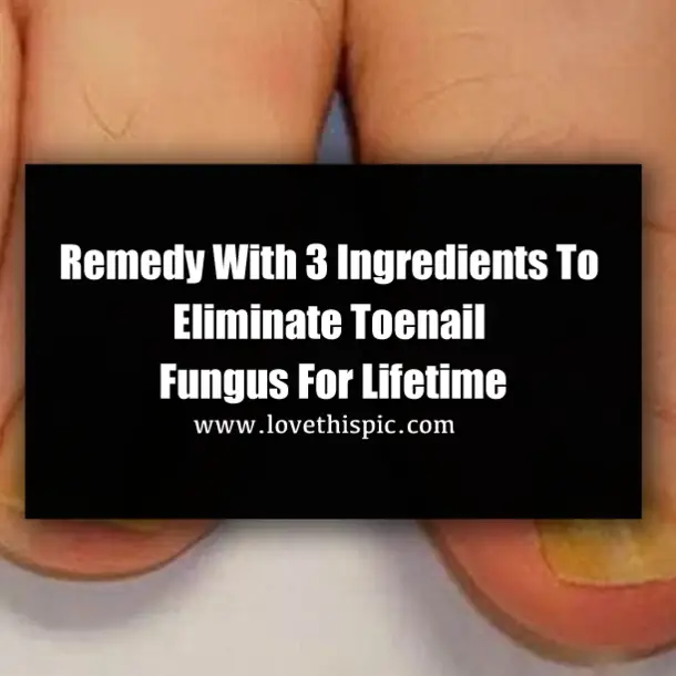 Remedy With 3 Ingredients To Eliminate Toenail Fungus For Lifetime ...