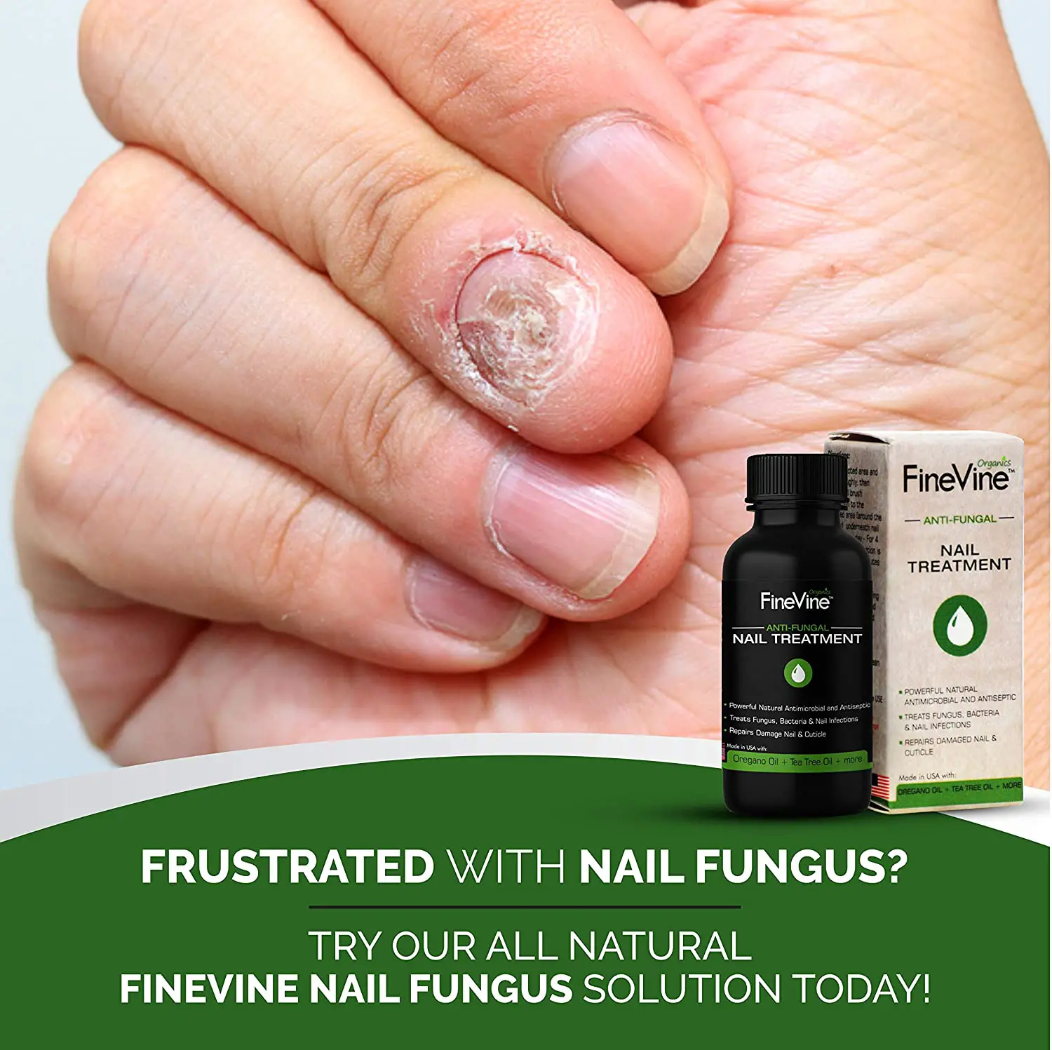 Sáº£n pháº©m Extra Strong Finger Toenail Fungus Treatment Organic USA Made ...