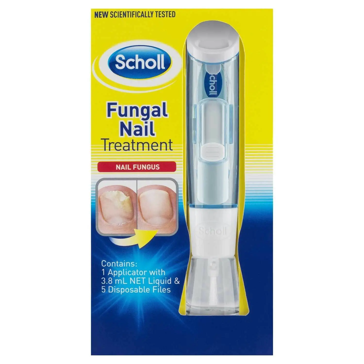 Scholl Fungal Nail Treatment 3.8ml proven to treat mild fungal nail ...