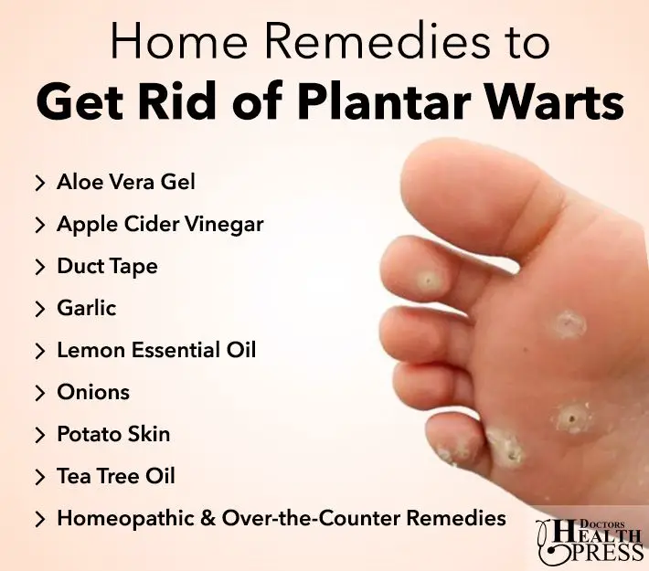 Simple Ways to Get Rid of Plantar Warts