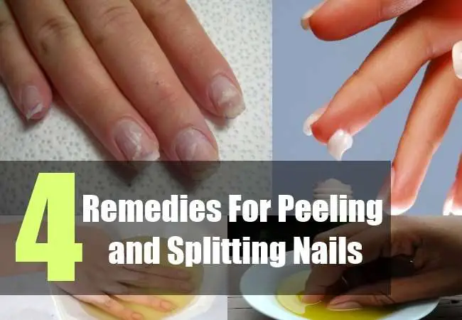 Splitting Nails