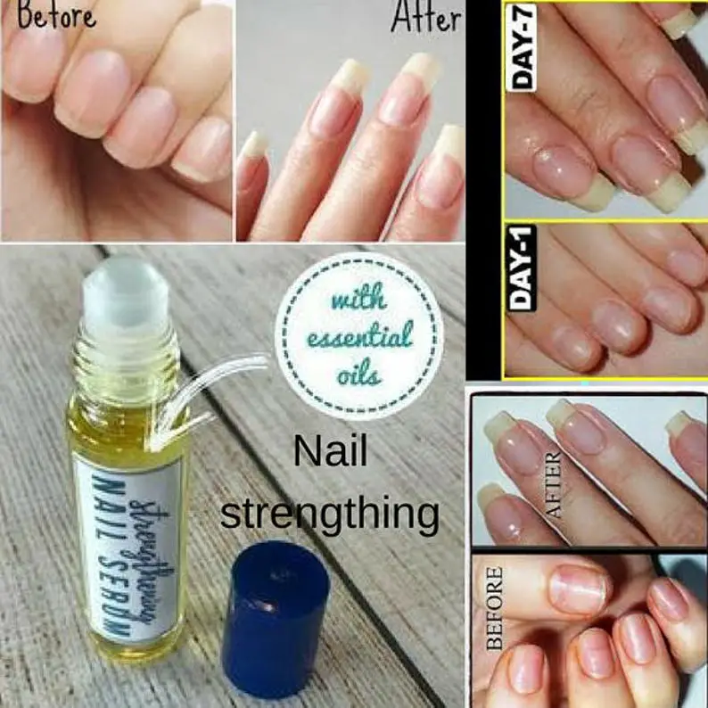 Strengthening Nail Serum for Weak Dry Brittle Fingernails It