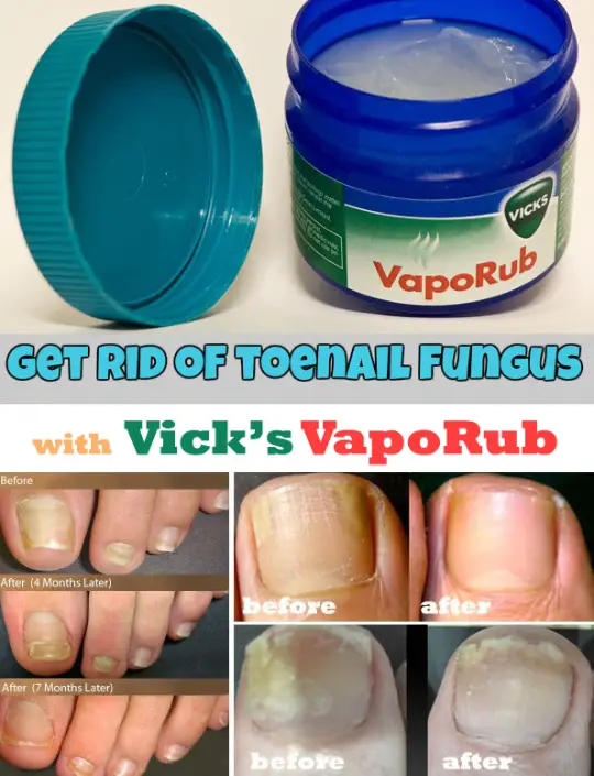 Surprising uses for Vick