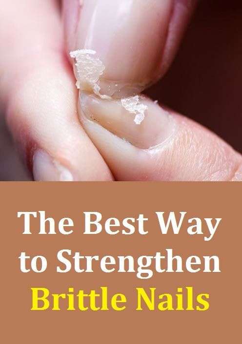 The Best Way to Strengthen Weak and brittle nails in 2020 ...