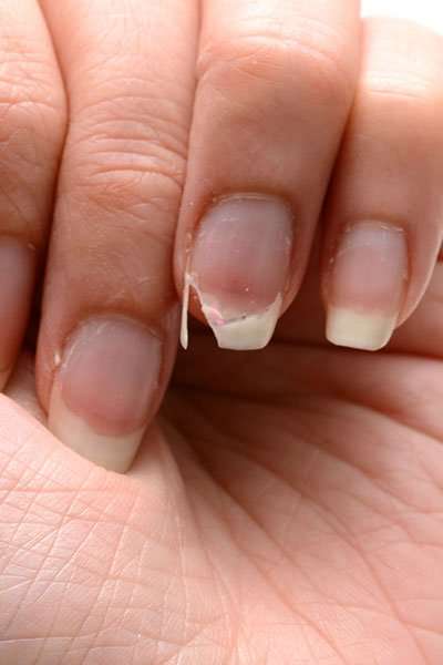 The One Thing You Should Never Do To A Broken Nail