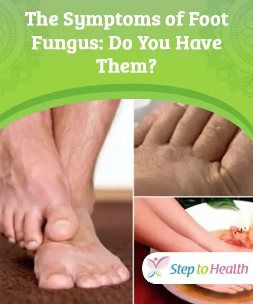 The Symptoms of Foot #Fungus: Do You Have Them? The #problem with ...