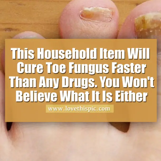 This Household Item Will Cure Toe Fungus Faster Than Any Drugs. You Won ...