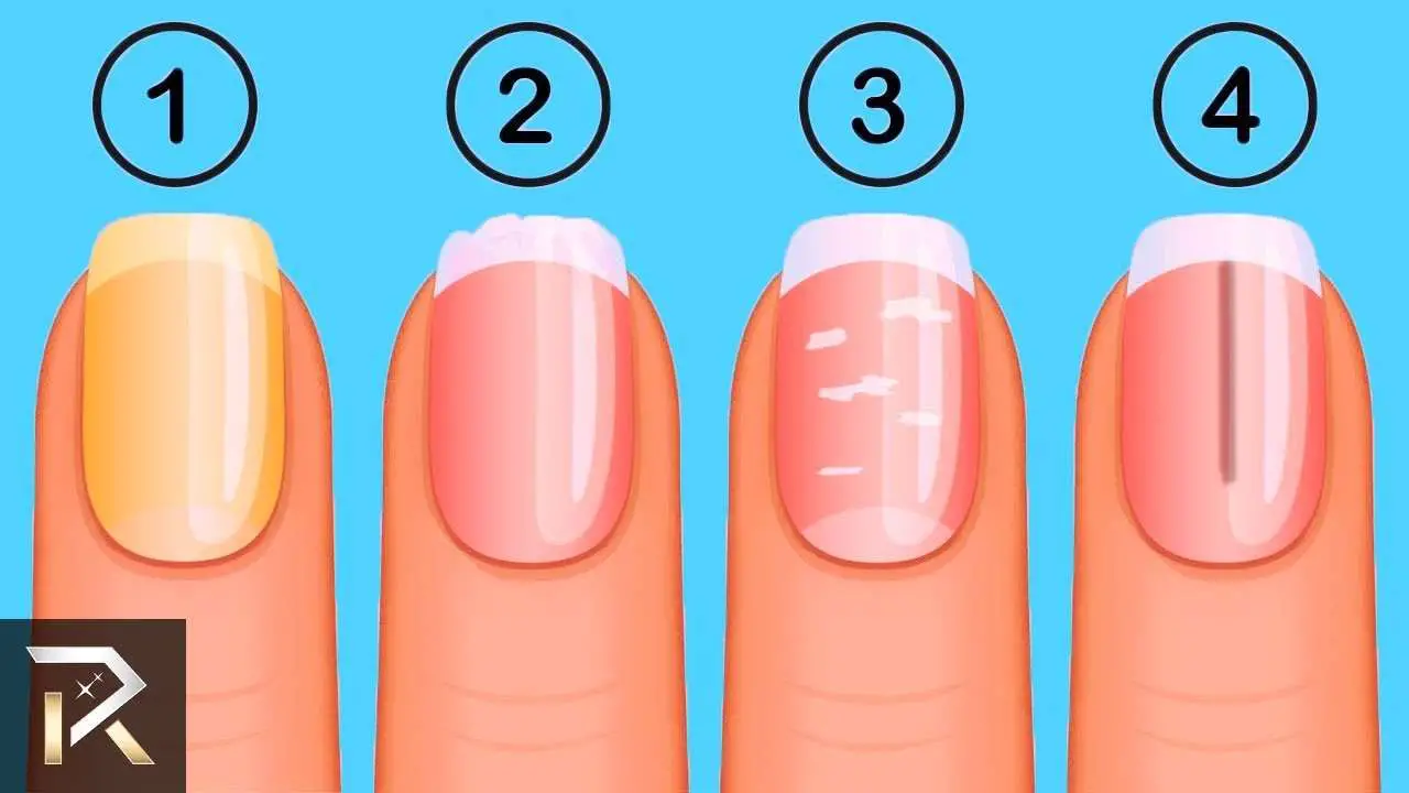 This Is What Your FINGERNAILS Say About Your Health