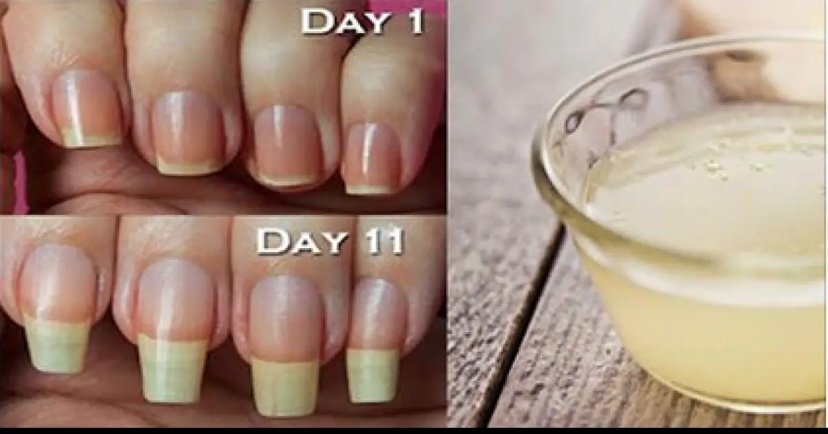 Tips To Grow Your Nails Longer, Faster