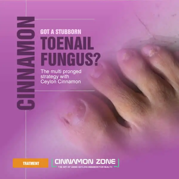 Toe Nail Fungus Cure with Cinnamon