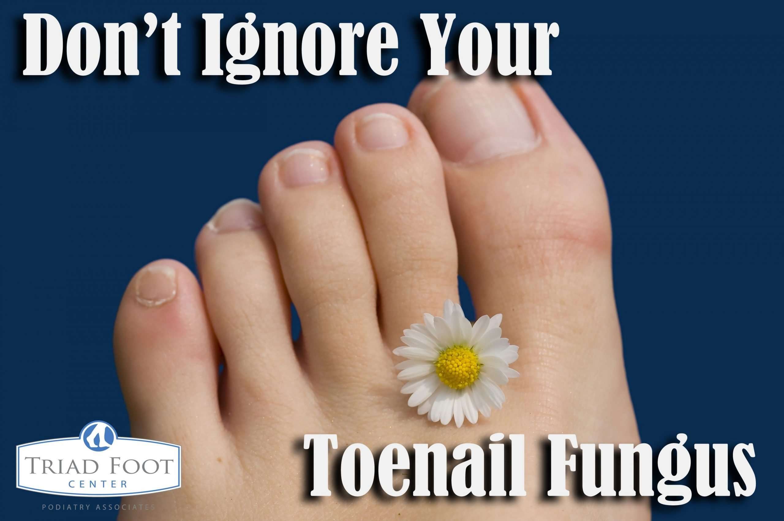 Toenail fungus is not a condition you can expect to get ...