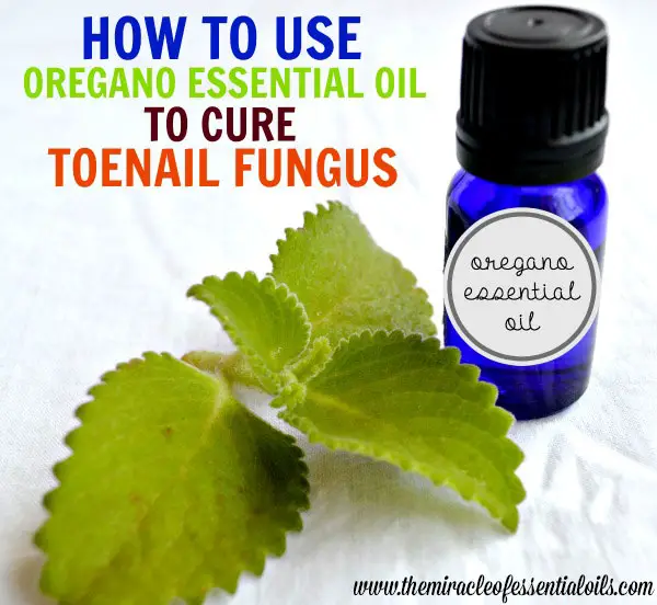 Using Oregano Essential Oil for Toenail Fungus