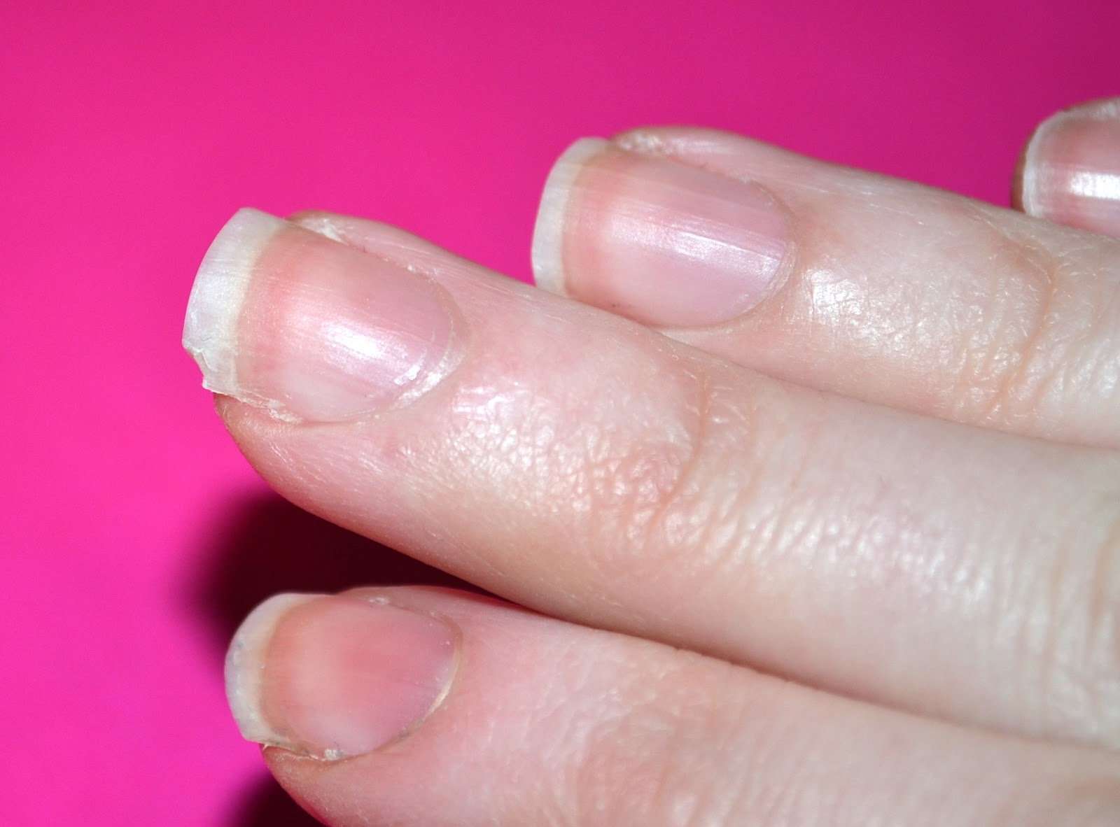 Very Enchanting: Repair your split or cracked nail with a ...
