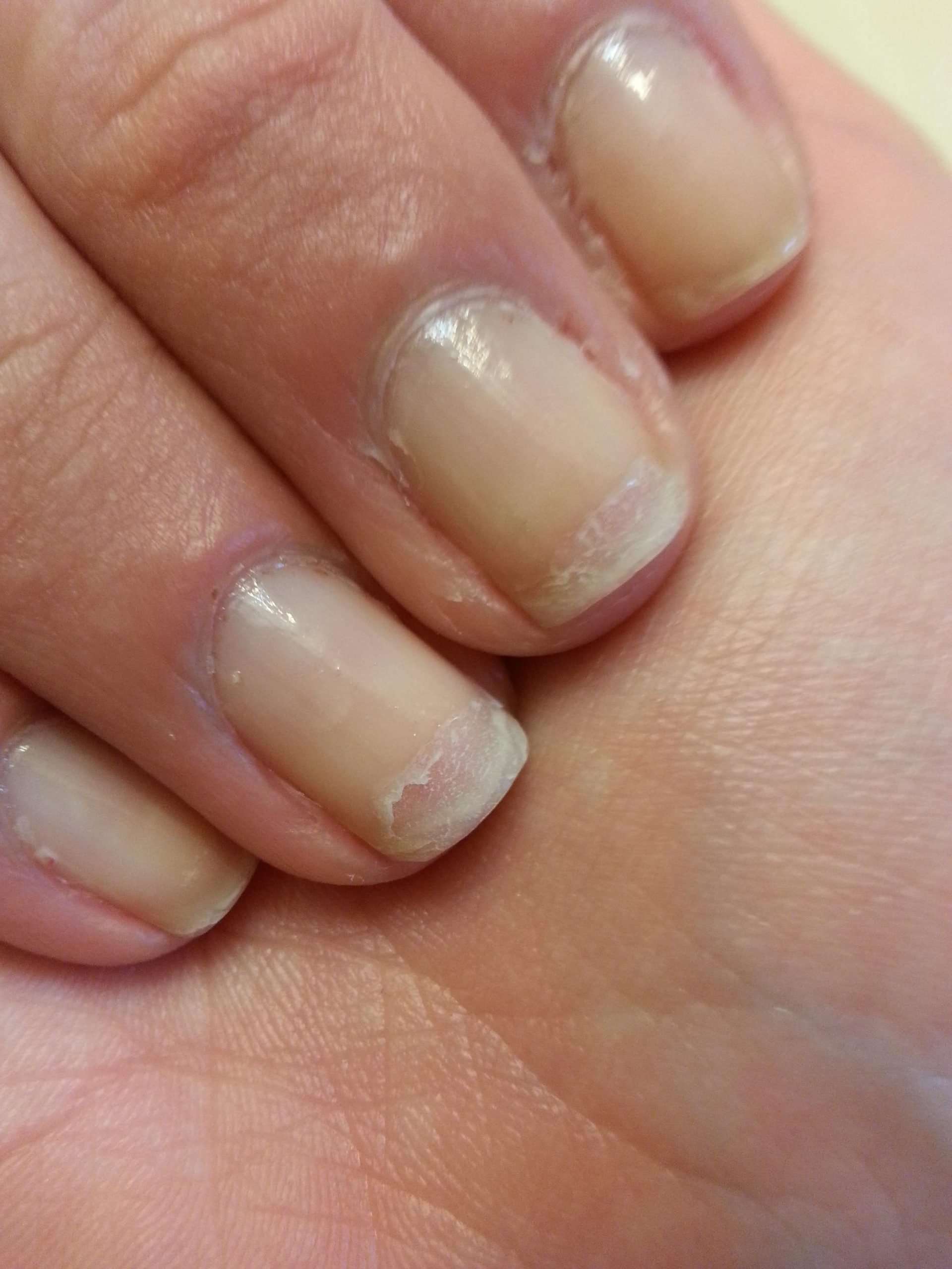 what do you ladies suggest to prevent my nails from ...