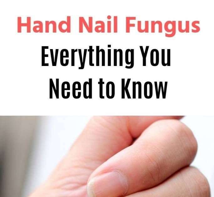 What Doctor Do I See For Fingernail Fungus