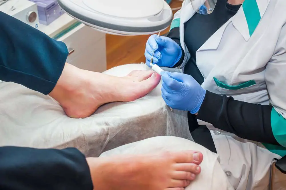 What To Do If Your Toenail Is Falling Off