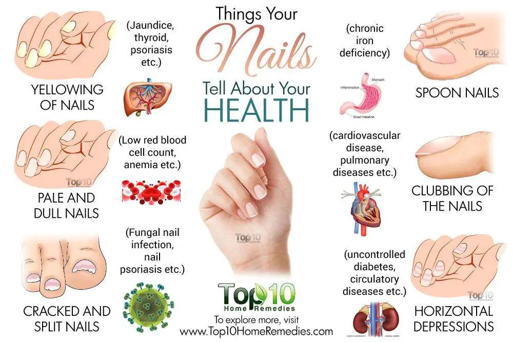 What Your Nails Reveal About Your Health