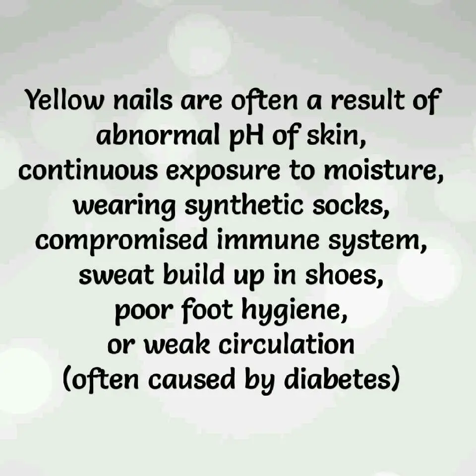 Yikes! Yellow Nails? Here